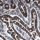 Immunohistochemical staining of human duodenum shows strong granular cytoplasmic positivity in glandular cells.