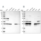 Anti-ECHS1 Antibody