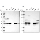 Western blot analysis using Anti-ECHS1 antibody HPA021995 (A) shows similar pattern to independent antibody HPA022476 (B).