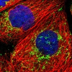 Immunofluorescent staining of human cell line A-431 shows localization to mitochondria.