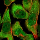 Immunofluorescent staining of human cell line U-251 MG shows localization to nucleoplasm & cytosol.