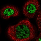 Immunofluorescent staining of human cell line A-431 shows localization to nuclear speckles.