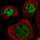 Immunofluorescent staining of human cell line A-431 shows localization to nuclear speckles.