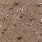 Immunohistochemical staining of human cerebral cortex shows moderate granular positivity in cytoplasm in neurons.