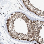 Immunohistochemical staining of human testis shows strong granular positivity in cytoplasm in cells in seminiferous ducts.