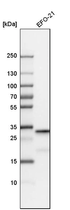 Western blot analysis in human cell line EFO-21.