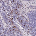 Anti-TNRC6C Antibody