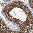 Anti-SPAG5 Antibody