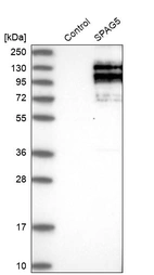 Western blot analysis in control (vector only transfected HEK293T lysate) and SPAG5 over-expression lysate (Co-expressed with a C-terminal myc-DDK tag (~3.1 kDa) in mammalian HEK293T cells, LY401941).