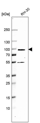 Western blot analysis in human cell line RH-30.