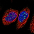 Anti-NOL11 Antibody