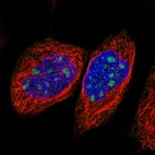 Immunofluorescent staining of human cell line A-431 shows localization to nucleoli.