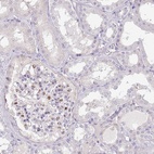 Anti-MRO Antibody