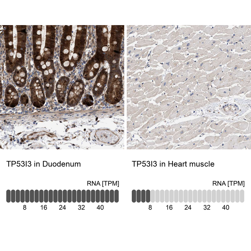 Anti-TP53I3 Antibody