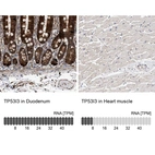 Anti-TP53I3 Antibody