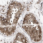 Immunohistochemical staining of human testis shows strong cytoplasmic positivity in cells in seminiferous ducts.