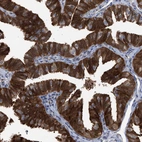 Immunohistochemical staining of human fallopian tube shows strong cytoplasmic positivity in glandular cells.