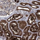 Immunohistochemical staining of human kidney shows strong cytoplasmic positivity in cells in tubules.