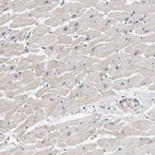 Immunohistochemical staining of human heart muscle shows no positivity in cardiomyocytes as expected.