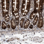 Immunohistochemical staining of human duodenum shows strong cytoplasmic positivity in glandular cells.