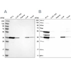 Western blot analysis using Anti-TP53I3 antibody HPA022012 (A) shows similar pattern to independent antibody HPA028742 (B).