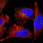 Immunofluorescent staining of human cell line U-251 MG shows localization to vesicles.