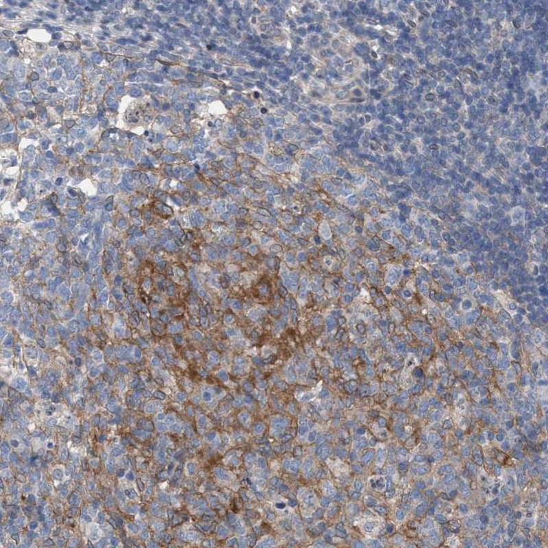 Anti-ARPC5L Antibody