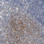 Anti-ARPC5L Antibody