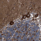 Immunohistochemical staining of human cerebellum shows strong cytoplasmic positivity in Purkinje cells.