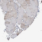 Immunohistochemical staining of human skeletal muscle shows very low positivity in myocytes as expected.