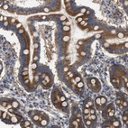 Immunohistochemical staining of human duodenum shows strong cytoplasmic positivity in glandular cells.
