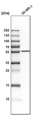 Western blot analysis in human cell line SK-BR-3.