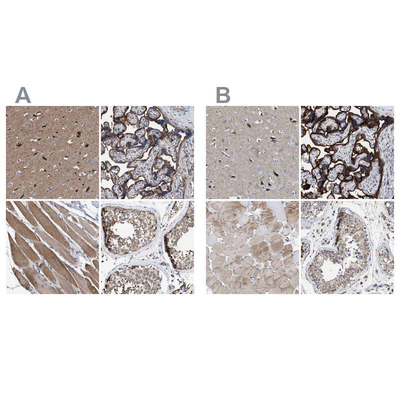 Anti-MECR Antibody