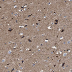 Immunohistochemical staining of human cerebral cortex shows strong cytoplasmic positivity in neurons.