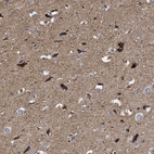 Immunohistochemical staining of human cerebral cortex shows strong cytoplasmic positivity in neurons.