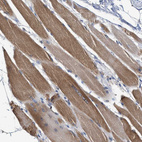 Immunohistochemical staining of human skeletal muscle shows moderate cytoplasmic positivity in myocytes.