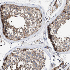 Immunohistochemical staining of human testis shows moderate cytoplasmic positivity in cells in seminiferous ducts.