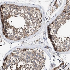 Immunohistochemical staining of human testis shows moderate cytoplasmic positivity in cells in seminiferous ducts.