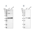 Western blot analysis using Anti-MECR antibody HPA022018 (A) shows similar pattern to independent antibody HPA028740 (B).