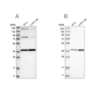 Western blot analysis using Anti-MECR antibody HPA022018 (A) shows similar pattern to independent antibody HPA028740 (B).