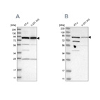 Anti-SPATA20 Antibody