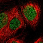 Immunofluorescent staining of human cell line A-431 shows localization to nucleoplasm.