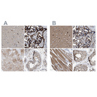 Anti-MECR Antibody