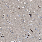 Immunohistochemical staining of human cerebral cortex shows strong cytoplasmic positivity in neurons.