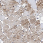Immunohistochemical staining of human skeletal muscle shows moderate cytoplasmic positivity in myocytes.