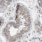 Immunohistochemical staining of human testis shows moderate cytoplasmic positivity in cells in seminiferous ducts.