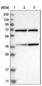 Lane 1: Marker [kDa] 230, 130, 95, 72, 56, 36, 28, 17, 11_br/_Lane 2: Human cell line RT-4_br/_Lane 3: Human cell line U-251MG sp