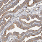 Immunohistochemical staining of human fallopian tube shows strong positivity in cilia in glandular cells.