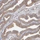 Immunohistochemical staining of human fallopian tube shows strong positivity in cilia in glandular cells.