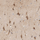 Immunohistochemical staining of human cerebral cortex shows moderate cytoplasmic positivity in neuronal cells.
